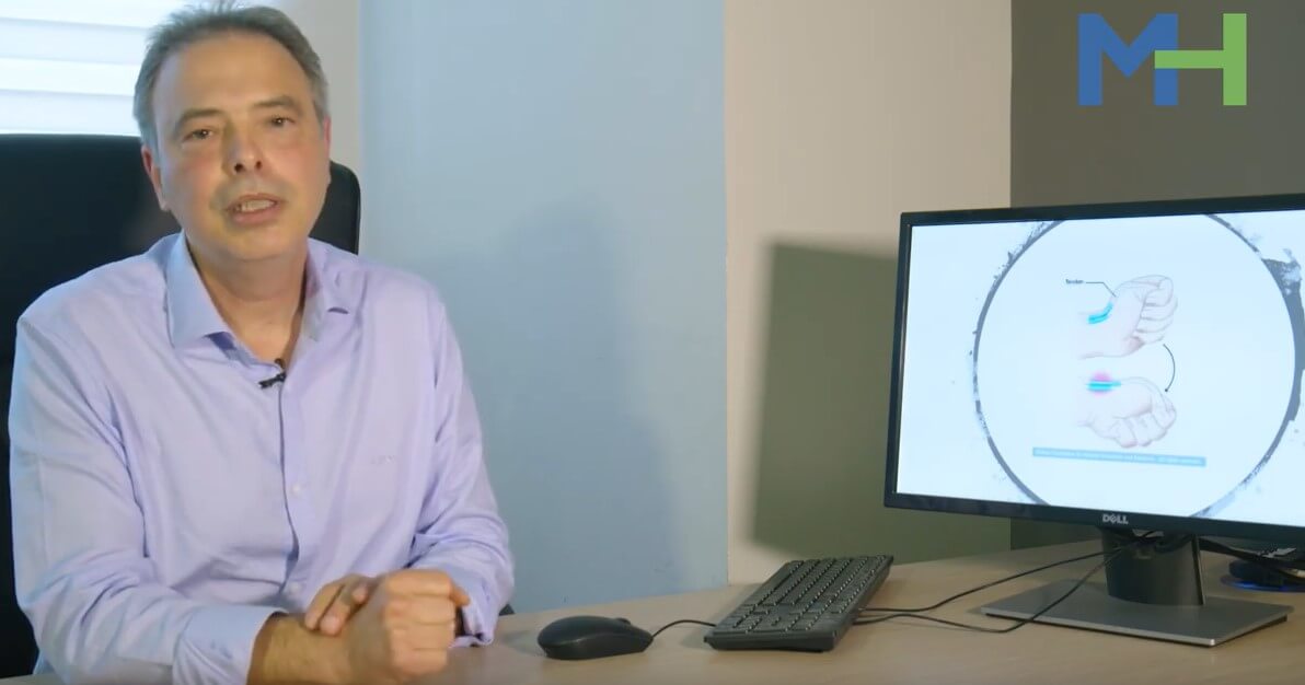 דה קרווין תמונה