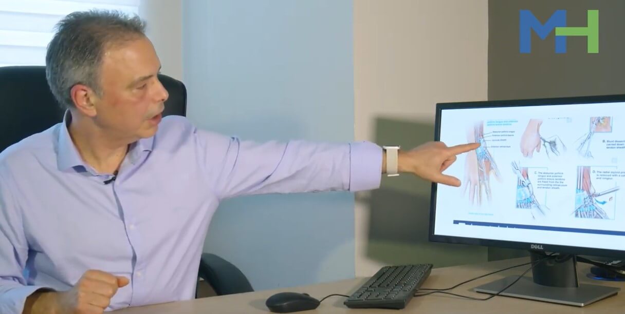 דה קרווין תמונה 4